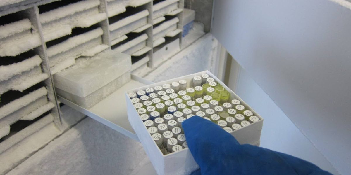 The 24-Hour Cliff: Why "Same-Day" is the New Standard for PBMC Isolation